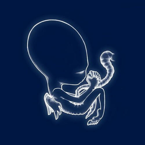 Sigur Ros: Agaetis Byrjun [ Vinyl ]